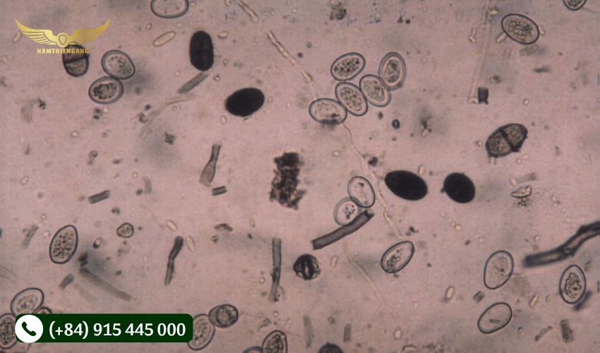 Tác nhân gây ra bệnh nứt vỏ 